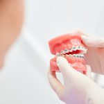 歯並び・噛み合わせが悪いと起こるデメリットとは？